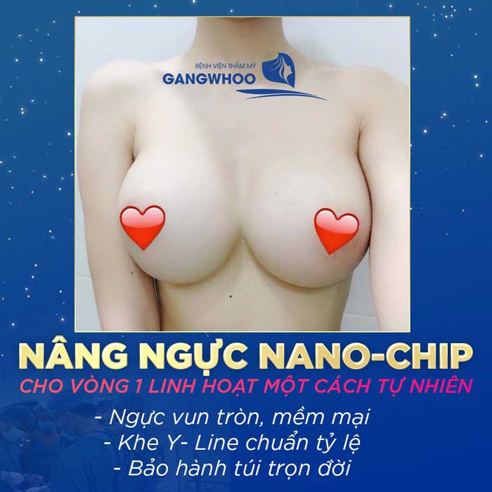 Nâng ngực túi Nano 